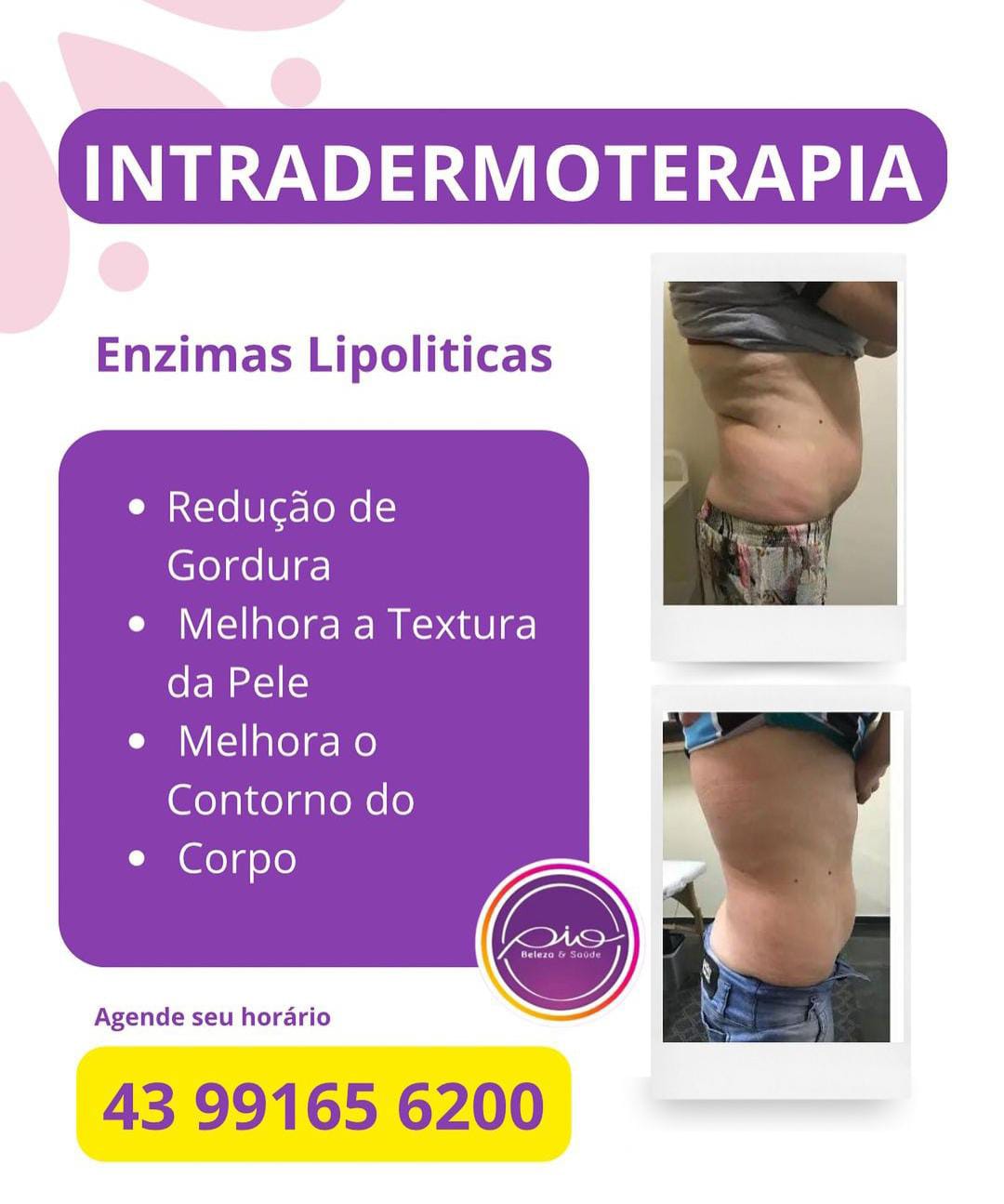 Enzimas Lipolíticas